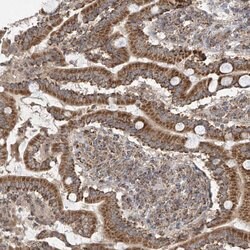 Invitrogen UQCC1 Polyclonal Antibody 100 &mu;L; Unconjugated:Antibodies,