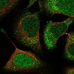 Invitrogen ACYP1 Polyclonal Antibody 100 &mu;L; Unconjugated:Antibodies,
