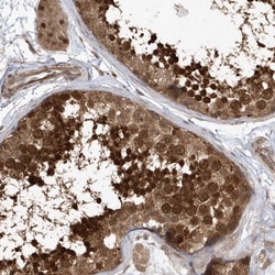 Invitrogen ACYP1 Polyclonal Antibody 100 &mu;L; Unconjugated:Antibodies,