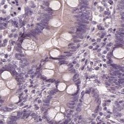 Invitrogen Opticin Polyclonal Antibody 100 &mu;L; Unconjugated:Antibodies,
