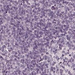 Invitrogen Opticin Polyclonal Antibody 100 &mu;L; Unconjugated:Antibodies,
