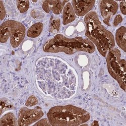 Invitrogen PRSS53 Polyclonal Antibody 100 &mu;L; Unconjugated:Antibodies,