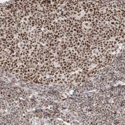 Invitrogen ARGLU1 Polyclonal Antibody 100 &mu;L; Unconjugated:Antibodies,