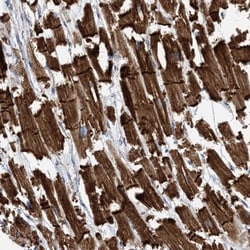 Invitrogen FAM26E Polyclonal Antibody 100 &mu;L; Unconjugated:Antibodies,