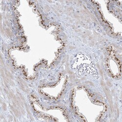 Invitrogen AFTPH Polyclonal Antibody 100 &mu;L; Unconjugated:Antibodies,