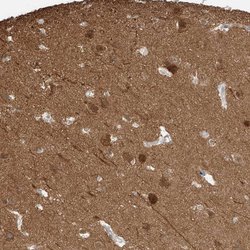 Invitrogen LANCL1 Polyclonal Antibody 100 &mu;L; Unconjugated:Antibodies,
