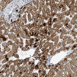 Invitrogen ATP5I Polyclonal Antibody 100 &mu;L; Unconjugated:Antibodies,