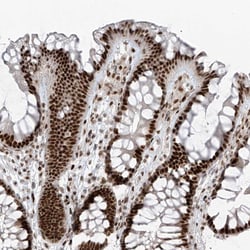 Invitrogen PCNP Polyclonal Antibody 100 &mu;L; Unconjugated:Antibodies,