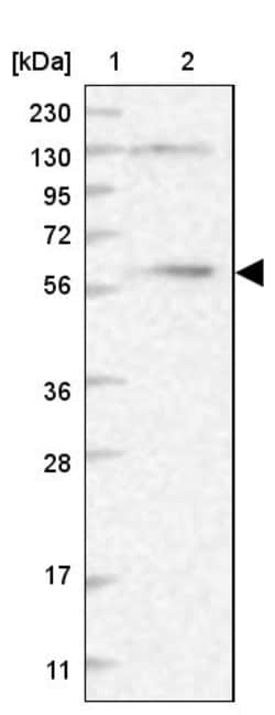 Invitrogen DYNC1LI1 Polyclonal Antibody 100 &mu;L; Unconjugated:Antibodies,