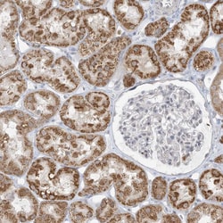 Invitrogen KIAA1310 Polyclonal Antibody 100 &mu;L; Unconjugated:Antibodies,