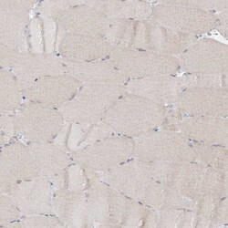 Invitrogen KIAA1310 Polyclonal Antibody 100 &mu;L; Unconjugated:Antibodies,