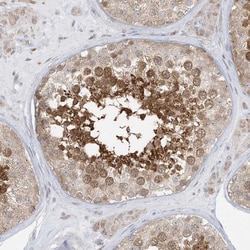 Invitrogen KIAA1310 Polyclonal Antibody 100 &mu;L; Unconjugated:Antibodies,