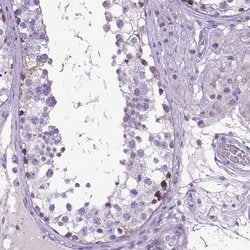 Invitrogen PLK5 Polyclonal Antibody 100 &mu;L; Unconjugated:Antibodies,