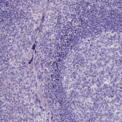 Invitrogen PLK5 Polyclonal Antibody 100 &mu;L; Unconjugated:Antibodies,