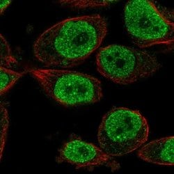 Invitrogen KLH18 Polyclonal Antibody 100 &mu;L; Unconjugated:Antibodies,