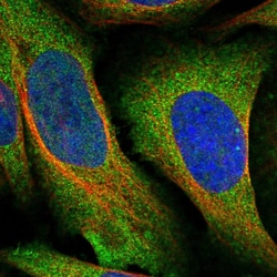 Invitrogen Grancalcin Polyclonal Antibody 100 &mu;L; Unconjugated:Antibodies,
