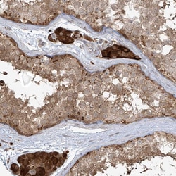 Invitrogen PLEKHM3 Polyclonal Antibody 100 &mu;L; Unconjugated:Antibodies,