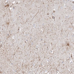 Invitrogen ETAA1 Polyclonal Antibody 100 &mu;L; Unconjugated:Antibodies,