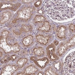 Invitrogen GRB14 Polyclonal Antibody 100 &mu;L | Buy Online | Invitrogen&trade; | Fisher Scientific