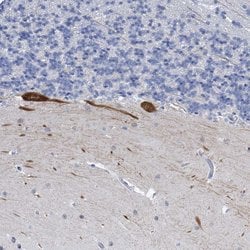 Invitrogen Neurotrypsin Polyclonal Antibody 100 &mu;L; Unconjugated:Antibodies,
