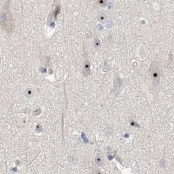 Invitrogen MPP10 Polyclonal Antibody 100 &mu;L; Unconjugated:Antibodies,