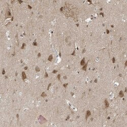 Invitrogen MAST3 Polyclonal Antibody 100 &mu;L; Unconjugated:Antibodies,