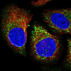 Invitrogen ABHD7 Polyclonal Antibody 100 &mu;L; Unconjugated:Antibodies,