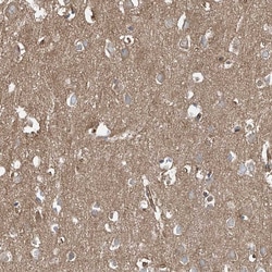 Invitrogen ABHD7 Polyclonal Antibody 100 &mu;L; Unconjugated:Antibodies,