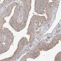 Invitrogen ABHD7 Polyclonal Antibody 100 &mu;L; Unconjugated:Antibodies,