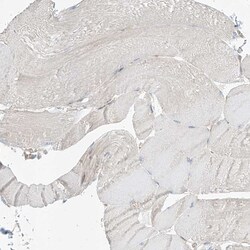 Invitrogen ABHD7 Polyclonal Antibody 100 &mu;L; Unconjugated:Antibodies,