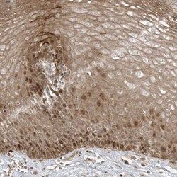 Invitrogen TTC22 Polyclonal Antibody 100 &mu;L | Buy Online | Invitrogen&trade; | Fisher Scientific