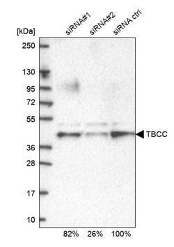 Invitrogen TBCC Polyclonal Antibody 100 μL; Unconjugated:Antibodies,
