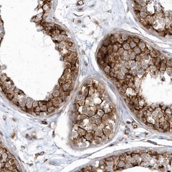 Invitrogen GPR152 Polyclonal Antibody 100 &mu;L; Unconjugated:Antibodies,