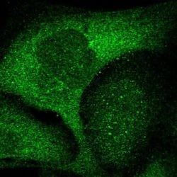 Invitrogen ZNF263 Polyclonal Antibody 100 &mu;L; Unconjugated:Antibodies,