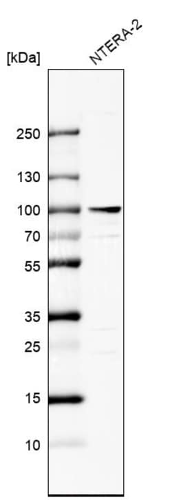 Invitrogen ZNF263 Polyclonal Antibody 100 &mu;L; Unconjugated:Antibodies,