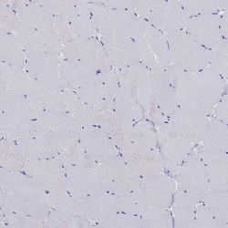 Invitrogen CRYGS Polyclonal Antibody 100 &mu;L; Unconjugated:Antibodies,