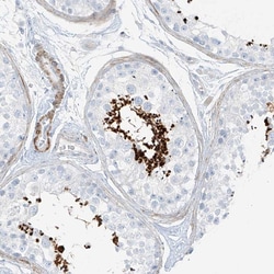 Invitrogen SMCP Polyclonal Antibody 100 &mu;L; Unconjugated:Antibodies,