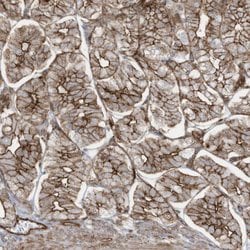 Invitrogen SLC9A2 Polyclonal Antibody 100 &mu;L; Unconjugated:Antibodies,