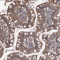 Invitrogen CHPF Polyclonal Antibody 100 &mu;L; Unconjugated:Antibodies,