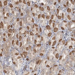 Invitrogen TBC1D5 Polyclonal Antibody 100 &mu;L; Unconjugated:Antibodies,