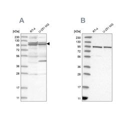 Invitrogen TBC1D5 Polyclonal Antibody 100 &mu;L; Unconjugated:Antibodies,