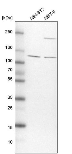 Invitrogen TBC1D5 Polyclonal Antibody 100 &mu;L; Unconjugated:Antibodies,