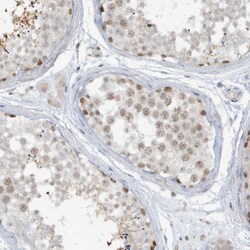 Invitrogen PRRT3 Polyclonal Antibody 100 μL; Unconjugated:Antibodies,