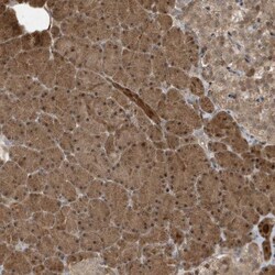 Invitrogen CATSPERB Polyclonal Antibody 100 &mu;L; Unconjugated:Antibodies,