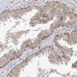 Invitrogen RABL3 Polyclonal Antibody 100 &mu;L; Unconjugated:Antibodies,