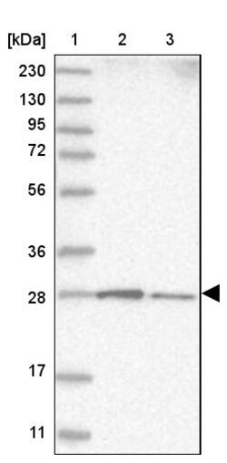 Invitrogen RABL3 Polyclonal Antibody 100 &mu;L; Unconjugated:Antibodies,