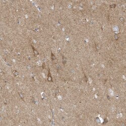 Invitrogen SLC38A2 Polyclonal Antibody 100 &mu;L; Unconjugated:Antibodies,