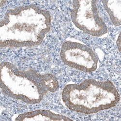Invitrogen SLC38A2 Polyclonal Antibody 100 &mu;L; Unconjugated:Antibodies,