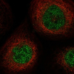 Invitrogen SLC25A43 Polyclonal Antibody 100 &mu;L; Unconjugated:Antibodies,