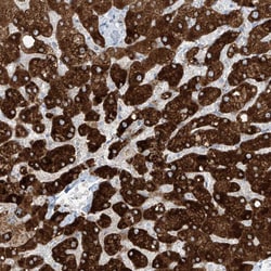 Invitrogen SLC25A43 Polyclonal Antibody 100 &mu;L; Unconjugated:Antibodies,